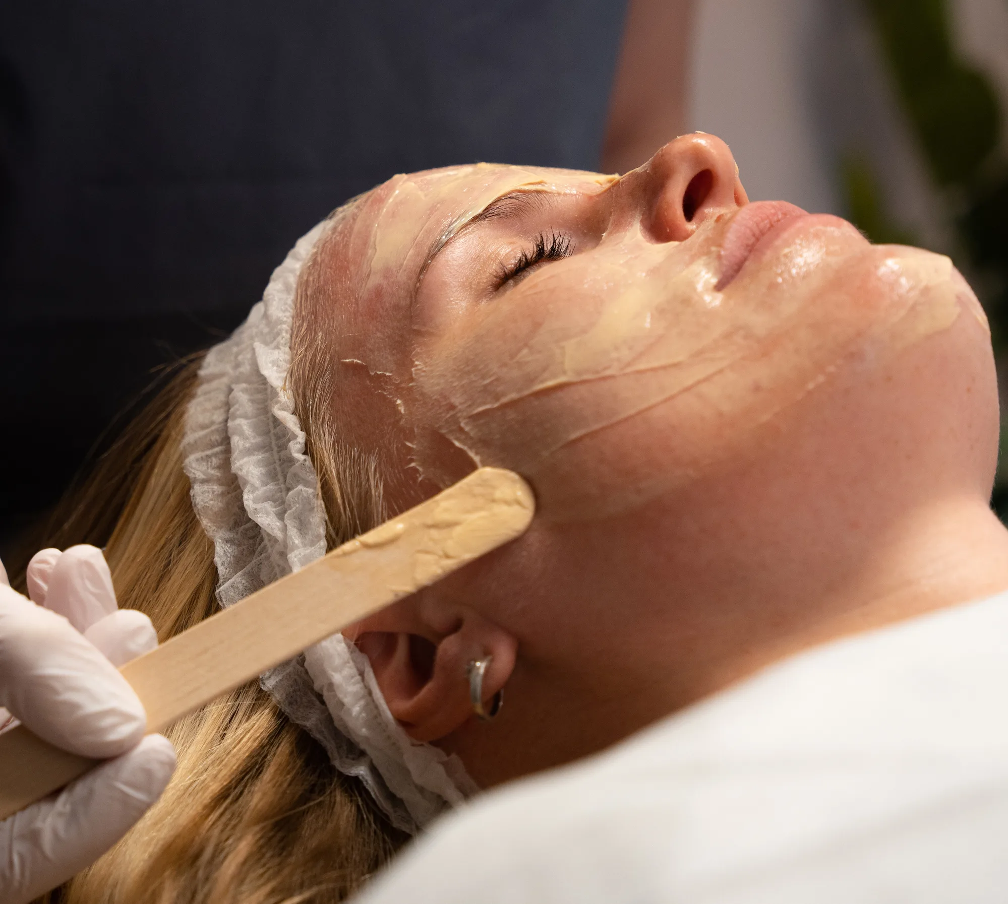 Behandling for pigmentflekker